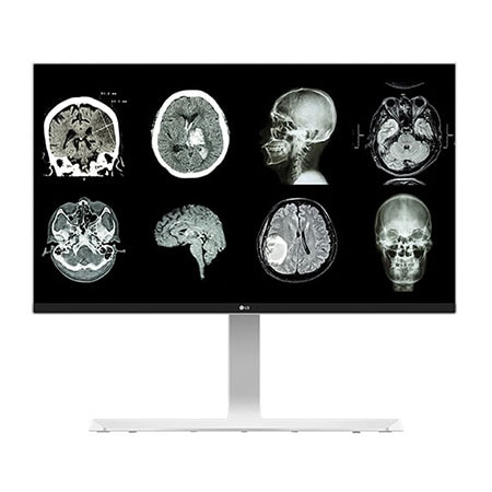 27 (68.58cm)UHD 8MP Clinical Review Monitor