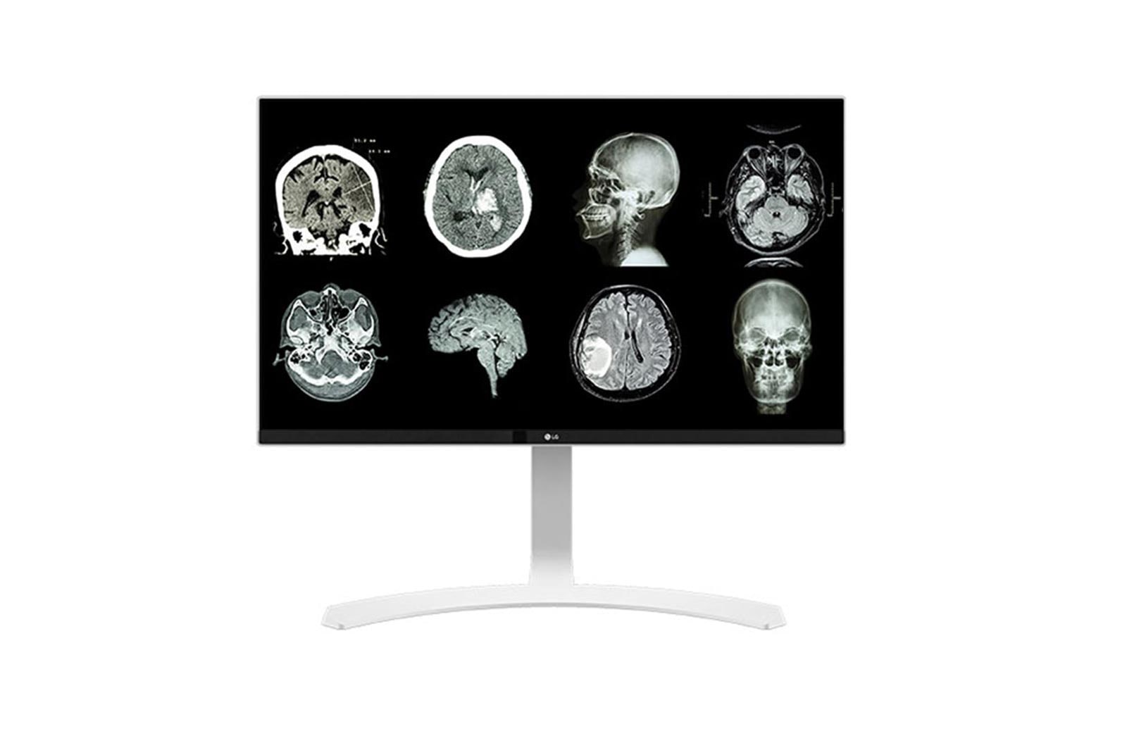 LG 27 (68.58cm) UHD 8MP Clinical Review Monitor, 27HJ712C-W