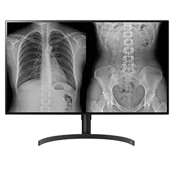 LG medizinische Monitore