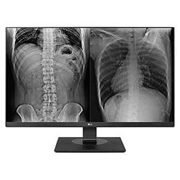 Monitores de revisión clínica