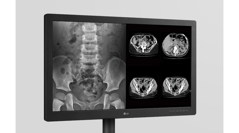 Reliable Imaging for Critical Assessment
