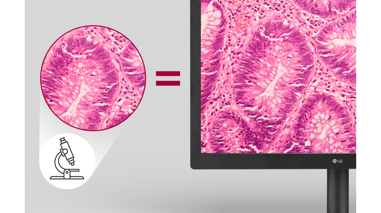 Just Like Looking at a Microscope