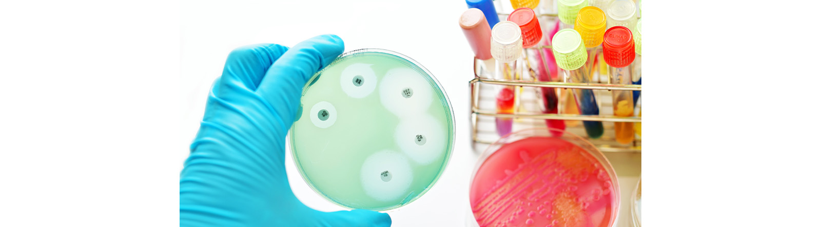The image shows a hand in a blue glove holding a petri dish with a green agar plate with test tubes in the background.