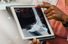 A healthcare professional shows a foot and ankle X-ray on a tablet.