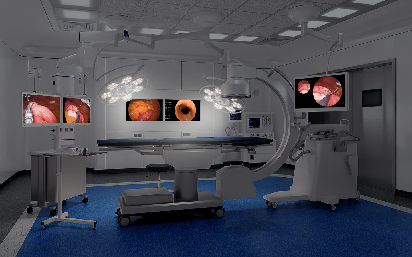 A modern operating room with surgical lights, medical monitors showing endoscopic images, and various equipment around the table.
